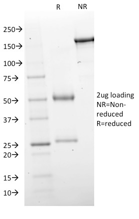 Data from SDS-PAGE analysis of Anti-GAD1 antibody (Clone GAD1/2563). Reducing lane (R) shows heavy and light chain fragments. NR lane shows intact antibody with expected MW of approximately 150 kDa. The data are consistent with a high purity, intact mAb.